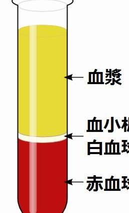 排便带血，白条状物怎么回事？